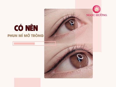 Có nên phun mí mở tròng? Phun mí mở tròng có ảnh hưởng thị lực không?