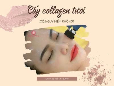 Cấy Collagen Tươi Có Nguy Hiểm Không? Sự Thật 70% Chị Em Chưa Biết