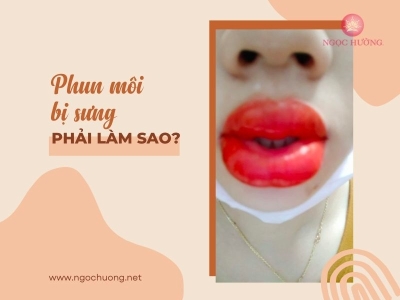Phun Môi Bị Sưng Phải Làm Sao? Giải Đáp Thắc Mắc Cùng Chuyên Gia
