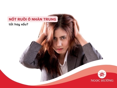 Luận tướng nốt ruồi ở nhân trung phụ nữ là tốt hay xấu?