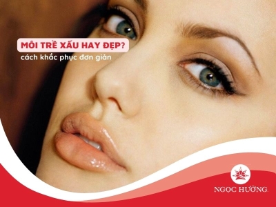 Môi trề xấu hay đẹp? 3 Cách khắc phục môi trề đơn giản