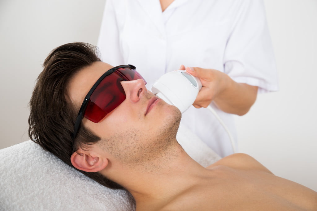 Chi phí triệt râu vĩnh viễn
