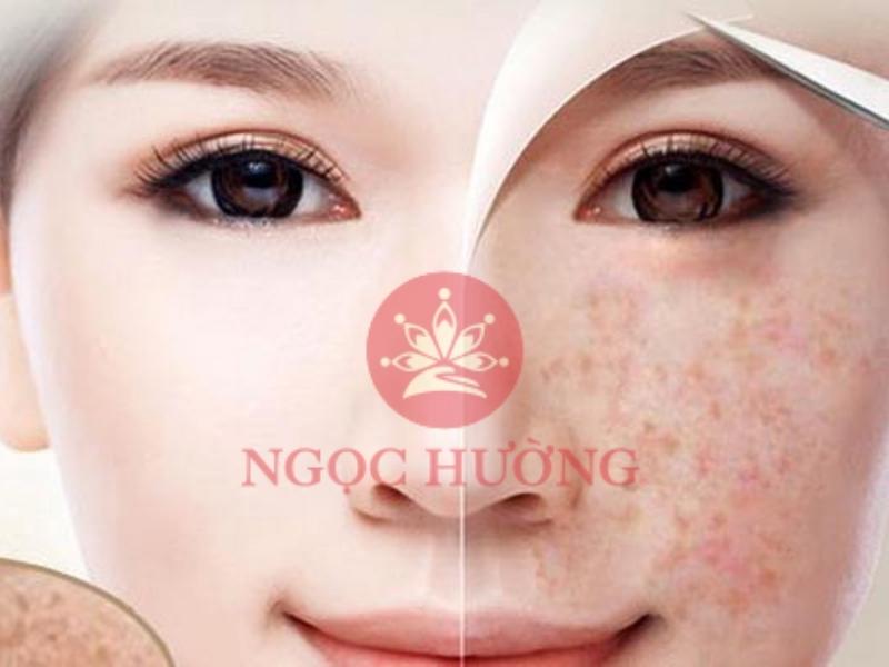 TMV Ngọc Hường - Địa chỉ trị tàn nhang uy tín