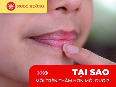 Tại sao môi trên thâm hơn môi dưới?