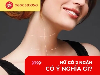 Nữ có cổ 2 ngấn nghĩa là gì? Xem tướng giàu sang phú quý