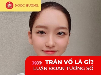 Trán vồ là gì? Tướng số người trán vồ tốt hay xấu?