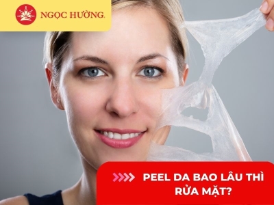 Peel da bao lâu thì rửa mặt? 3 điều bạn nên biết