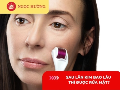 Sau lăn kim bao lâu thì được rửa mặt? Cách chăm sóc da sau lăn kim
