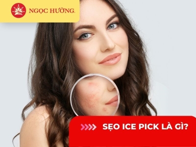 Sẹo ice pick là gì? 5 cách trị sẹo rỗ (ice pick) hiệu quả nhất