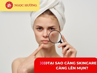 Tại sao càng skincare càng lên mụn? 5 lý do bạn nên biết
