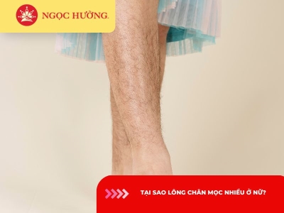 7 lý do lông chân mọc nhiều ở nữ cần biết và cách khắc hiệu quả