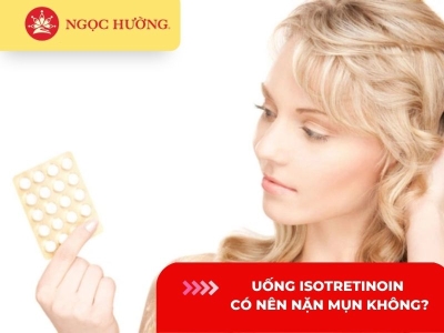 Uống isotretinoin có nên nặn mụn không? Nên hay không nên