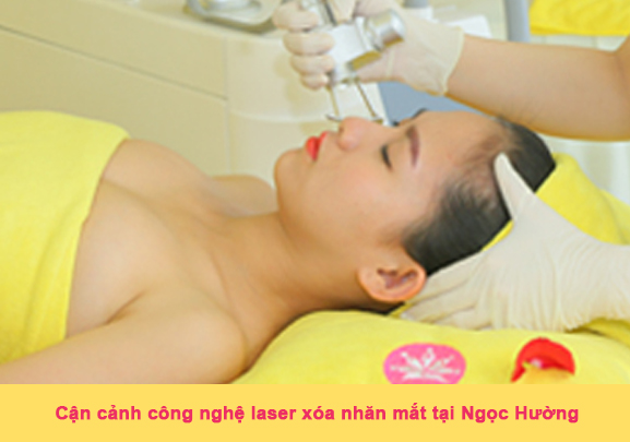 xóa nhăn vùng mắt