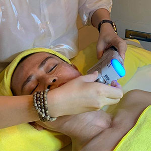HIFU xóa nếp nhăn